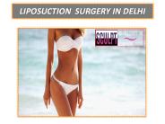 Liposuction Surgery in South Delhi