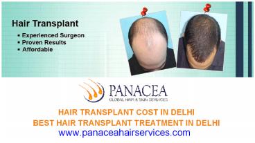 How Hair Is Inserted in Hair Transplant Surgery - Panacea Hair and Skin Services