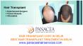 How Hair Is Inserted in Hair Transplant Surgery - Panacea Hair and Skin Services PowerPoint PPT Presentation