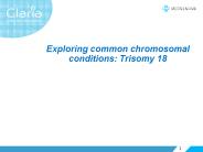 Exploring common chromosomal conditions: Trisomy 18