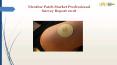 Nicotine Patch Market Professional Survey Report 2018 PowerPoint PPT Presentation