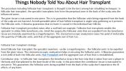 FUE Hair Transplant