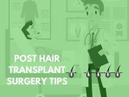 Hair Transplant Surgery Tips