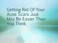 Getting Rid Of Your Acne Scars Just May Be Easier Than You Think PowerPoint PPT Presentation