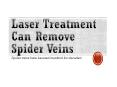 Laser Treatment Can Remove Spider Veins