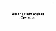 Beating Heart Bypass Surgery