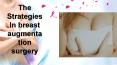 THE STRATEGIES IN BREAST AUGMENTATION SURGERY PowerPoint PPT Presentation