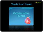 Valvular Heart Disease: Symptoms, Causes, Diagnosis and Treatment (1)