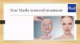 Laser Acne Scar Removal Treatment | Microdermabrasion in Hyderabad PowerPoint PPT Presentation