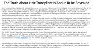 Hair Transplant Turkey