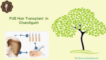 FUE Hair Transplant at Clinic in Chandigarh - At Kabera Global