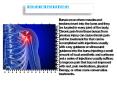 Bursa injection for joint pain PowerPoint PPT Presentation