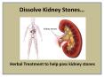 Kidney Stone HAshmi PowerPoint PPT Presentation