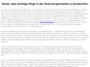 Haartransplantation