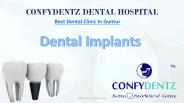 Dental Implants in Guntur