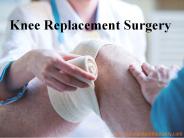 PPT | Things you should know about knee replacement surgery