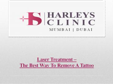 Laser Treatment – The Best Way To Remove A Tattoo