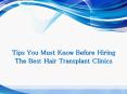 Hair Transplant Clinic PowerPoint PPT Presentation