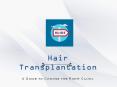 Guide For Hair Transplant PowerPoint PPT Presentation