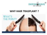 Benefits of Hair Transplant treatment