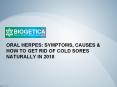 Oral Herpes: Symptoms, Causes & How to get rid of Cold Sores Naturally in 2018 - Biogetica PowerPoint PPT Presentation