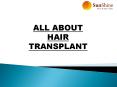 Top Best Hair Transplant In Delhi PowerPoint PPT Presentation