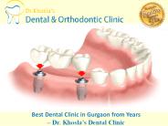 Looking for the Best Dental Clinic in Gurgaon? Contact Us.
