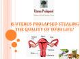 Is Uterus Prolapsed Stealing the Quality of Your Life? PowerPoint PPT Presentation