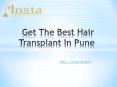Get The Best Hair Transplant In Pune PowerPoint PPT Presentation