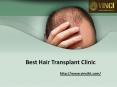 Best Hair Treatment Clinic PowerPoint PPT Presentation