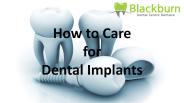How to Care for Dental Implants