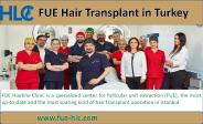 Hair Transplant In Istanbul