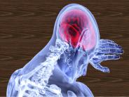 How to Recognize the Signs of a Stroke