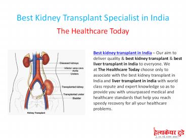 Best Kidney Transplant Specialist in India