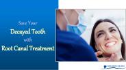 Save Your Decayed Tooth with Root Canal Treatment