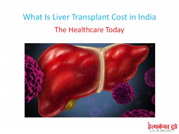 What Is Liver Transplant Cost in India