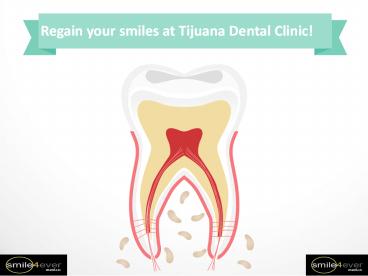 Regain your smiles at Tijuana Dental Clinic!
