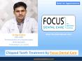 Chipped Tooth Treatment by Focus Dental Care PowerPoint PPT Presentation