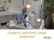 Cosmetic Dentistry & Smile Makeover