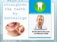 Deserving ways to straighten the teeth by Invisalign PowerPoint PPT Presentation