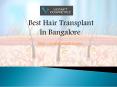 Best hair transplant in Bangalore PowerPoint PPT Presentation