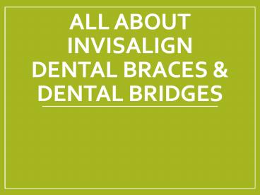 All About Invisalign Dental Braces & Dental Bridges