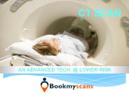 CT Scan Cost