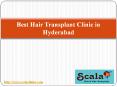 Best Hair Transplant Clinic in Hyderabad PowerPoint PPT Presentation