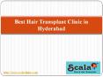 Best Hair Transplant Clinic in Hyderabad (1) PowerPoint PPT Presentation