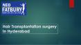 hair transplant in hyderabad | hair transplant services PowerPoint PPT Presentation