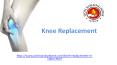 Knee Replacement in jaipur|Surgery|Symptoms|Causes|Risks|Rehabilitation PowerPoint PPT Presentation