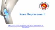 Knee Replacement in jaipur|Surgery|Symptoms|Causes|Risks|Rehabilitation