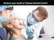 Restore your tooth at Tijuana Dental Center!