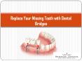 Brandon Dentist: Repalce Your  Missing Tooth With Dental Bridges PowerPoint PPT Presentation